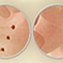 Mold Manzano Бордюр 5х50